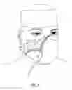 Fig. 04 - Odor neutralizing mask insert
