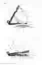 Fig. 04 - Fluid extraction device, applicator device and associated methods