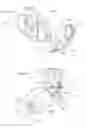 Fig. 55 - Heart help device, system, and method
