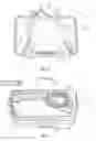 Fig. 04 - Mobile extracorporeal life support systems and related methods