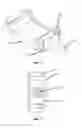 Fig. 06 - Compact pulmonary assist device for destination therapy