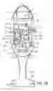 Fig. 03 - APHERESIS SYSTEM