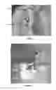 Fig. 02 - HEMODIALYSIS ACCESS SYSTEM