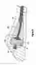 Fig. 07 - HEMODIALYSIS ACCESS SYSTEM