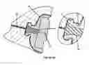 Fig. 08 - HEMODIALYSIS ACCESS SYSTEM