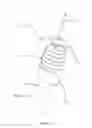 Fig. 12 - Needle based helical coil safety device