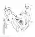 Fig. 01 - Fluid drive system for catheter articulation and other uses