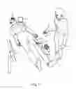 Fig. 02 - Fluid drive system for catheter articulation and other uses