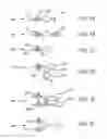 Fig. 09 - Fluid drive system for catheter articulation and other uses