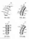 Fig. 28 - Fluid drive system for catheter articulation and other uses
