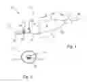 Fig. 02 - Catheter structures for reducing fluoroscopy usage during endovascular procedures