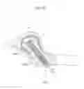 Fig. 05 - Hip joint device and method