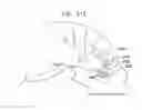 Fig. 43 - SAFETY DRUG HANDLING DEVICE