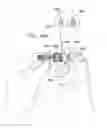 Fig. 71 - SAFETY DRUG HANDLING DEVICE