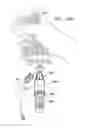 Fig. 74 - SAFETY DRUG HANDLING DEVICE
