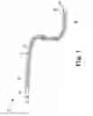 Fig. 02 - Medical electrical lead with biostable PVDF-based materials