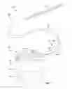 Fig. 02 - Burr hole plugs for electrical stimulation systems and methods of making and using