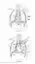 Fig. 08 - Systems, devices, and methods for improving hemodynamic performance through asymptomatic diaphragm stimulation