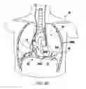 Fig. 09 - Systems, devices, and methods for improving hemodynamic performance through asymptomatic diaphragm stimulation