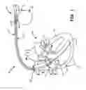Fig. 02 - METHOD OF OVERMOULDING TOP MOUNTED SEAL PLUG CAVITIES