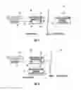 Fig. 02 - Neurological stimulator method with detachable lead connection arrangement