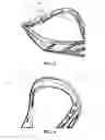 Fig. 06 - LACROSSE STICK HEAD WITH PROTECTED STRING ATTACHMENT FEATURE