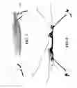 Fig. 07 - LACROSSE STICK HEAD WITH PROTECTED STRING ATTACHMENT FEATURE