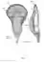 Fig. 07 - 3D PRINTED LACROSSE HEAD