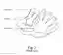 Fig. 07 - Ball glove