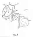 Fig. 09 - Ball glove