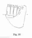 Fig. 14 - Ball glove