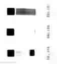 Fig. 17 - Systems and methods for unipolar separation of emulsions and other mixtures