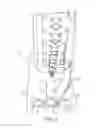 Fig. 04 - POSITIONING FOOT ATTACHMENT FOR A FASTENER DRIVING TOOL