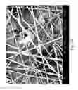 Fig. 05 - Enhanced co-formed/meltblown fibrous web structure