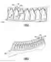 Fig. 03 - Work piece having self-supporting gusset and method related thereto