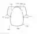 Fig. 01 - Vehicular airbag device
