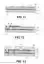 Fig. 09 - Planar cavity MEMS and related structures, methods of manufacture and design structures