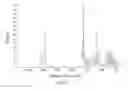 Fig. 09 - Polymorphic forms of the sodium salt of 4-tert-butyl-N-[4-chloro-2-(1-oxy-pyridine-4-carbonyl)-phenyl]-benzene sulfonamide