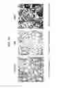 Fig. 02 - METHOD FOR TREATING ANTIBODY-MEDIATED REJECTION POST-TRANSPLANTATION