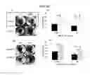 Fig. 05 - METHOD FOR TREATING ANTIBODY-MEDIATED REJECTION POST-TRANSPLANTATION