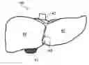 Fig. 01 - Hydrogel object and method of manufacturing hydrogel object
