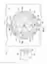 Fig. 10 - Radial microfluidic devices and methods of use