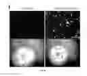 Fig. 08 - Method for generating endothelial colony forming cell-like cells