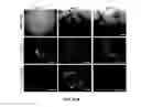 Fig. 13 - Method for generating endothelial colony forming cell-like cells