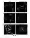 Fig. 16 - Method for generating endothelial colony forming cell-like cells