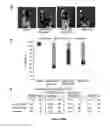 Fig. 17 - Method for generating endothelial colony forming cell-like cells