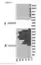 Fig. 07 - Method of target molecule characterisation using a molecular pore