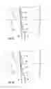 Fig. 07 - Light Blocking Slatted Blind