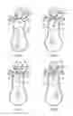Fig. 03 - Mesh anchored combustion internal combustion engine