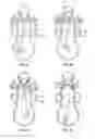 Fig. 05 - Mesh anchored combustion internal combustion engine
